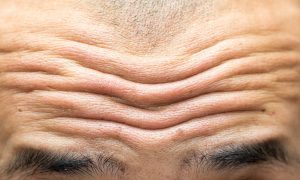 Duboke bore na čelu muškarca podsjećaju nas na spolno ovisne razlike u starenju kože.